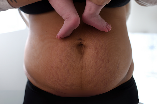 Postpartum Bleeding and Staying Comfortable